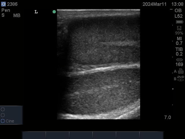 Ultrasonographic image of testicular longitudinal section