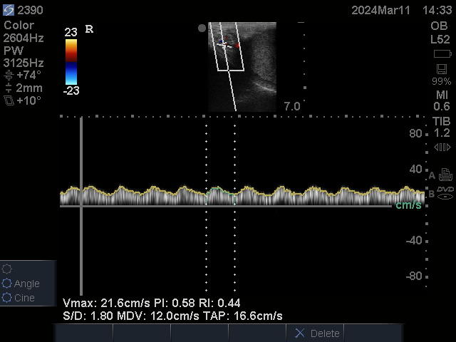 Testicular blood flow determination using doppler technology