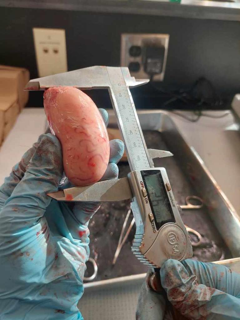 Measuring testicle with a caliper
