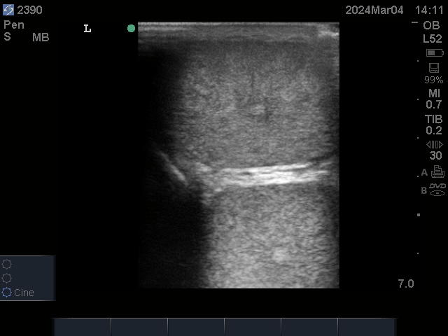 Ultrasonographic image of testicular cross section
